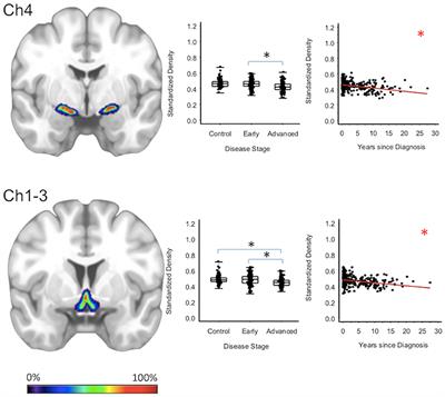 Frontiers | Brain MRI Reveals Ascending Atrophy In Parkinson's Disease ...